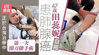 47歲田蕊妮自揭患肺腺癌台灣治療中：第一次開刀做手術｜01娛樂｜田蕊妮｜杜汶澤｜肺腺癌