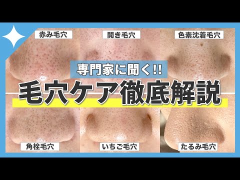 【閲覧注意】あなたはどのタイプ？毛穴6タイプ別👃原因とケアを徹底解説⚡️