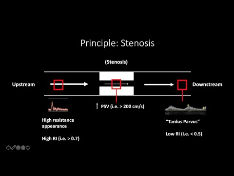 Doppler Ultrasound Part 1 - Principles (w/ focus on Spectral Waveforms)