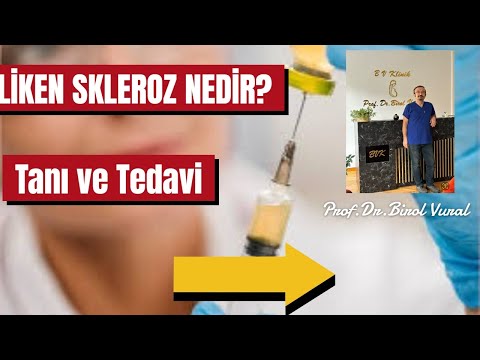 LİKEN SKLEROZ NEDİR? NASIL TANINIR VE TEDAVİ EDİLİR ?