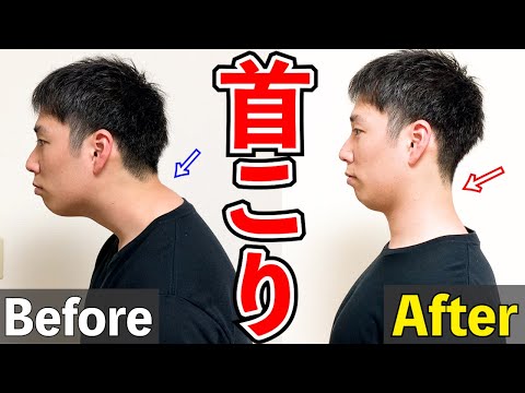 【首こり解消ストレッチ】誰でも簡単に首こりを解消するストレッチ！肩こり・頭痛改善にも！