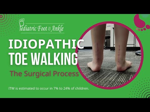 Idiopathic Toe Walking: The Surgical Process