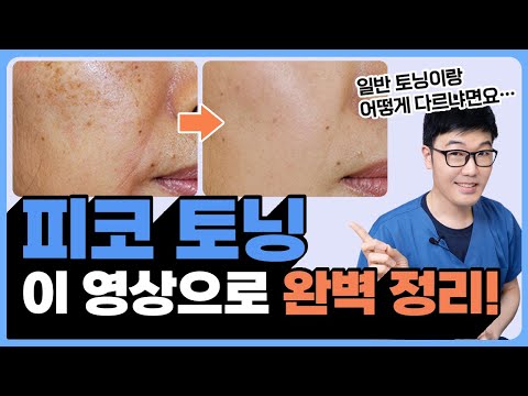 피코토닝 총정리! 레이저토닝vs피코토닝 승자는? (피코토닝 원리, 효과 등 모두 알려드립니다)