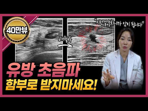 느리지만 확실히 유방암이 될 수 있는 조건 | 유방암 0기, 1기, 2기 병기별 특징