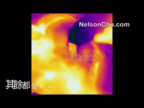 告訴你怎麼打電波拉皮不需要最高能量的原因How thermage works properly. No sliding skill!! Thermography tells all