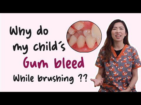 EP 84: Why do my child's gums bleed while brushing