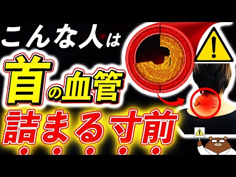 放置厳禁！知らないと後悔する「首」の血管が詰まる直前の危険サイン。「頸動脈狭窄症」の正体とは。「不安定プラーク」とは何？首のプラークは消せる？予防法は？医師が完全解説します。