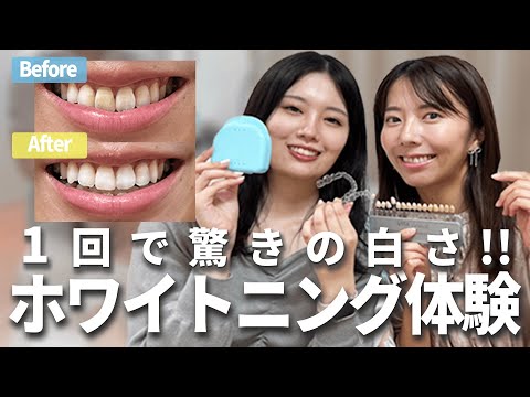 【ガチでおすすめ】虫歯予防もできるホワイトニング！【歯科医師解説】