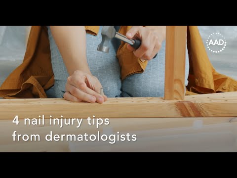 4 nail injury tips from dermatologists