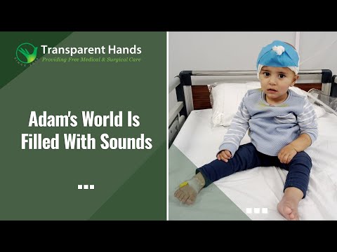 Adam Claims the Gift of Hearing | Cochlear Implant Surgery By Transparent Hands