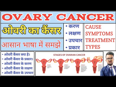 Ovary Cancer | Ovary Cancer Notes | Ovary sist Cyst | Ovary Cancer Treatment | Ovary Cust Treatment