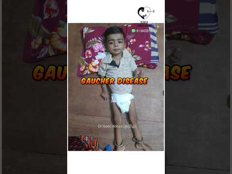 Gaucher disease