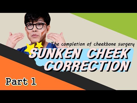 Don't get fillers for sunken cheeks! "Hollow cheeks correction"