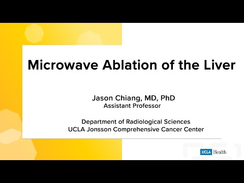 Microwave ablation of the liver | UCLA Health