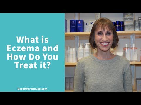 What is Eczema and How Do You Treat It?