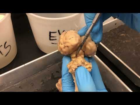 Dorsal View of Sheep Brain (Anatomy & Physiology I – BIO)