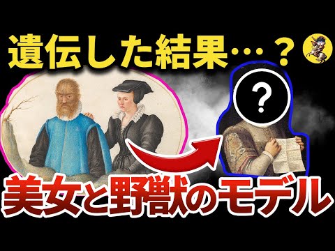 【驚愕】多毛症とは？美女と野獣の実物の悲惨な現実【世界史】