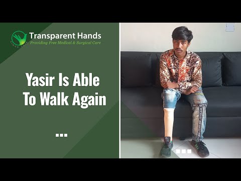 You Provided Yasir Ali with an Artificial Leg