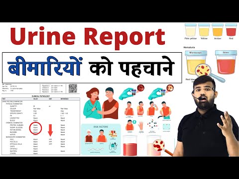 Urine Report | बीमारियां को पहचाने | Medicine  | Treatment | Doctor | Hospital | Medical | MBBS