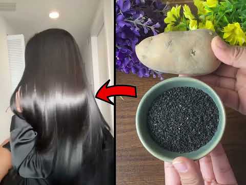 White Hair To Black Permanently in 30 Minutes Naturally | Potato For Jet Black At Home | 100% Works