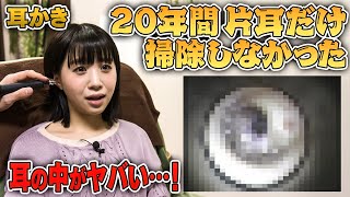 【 耳掃除  プロ 】耳の穴 が 掃除 しにくい形をしている 女子 の 耳の中を見てみたら…！！【 耳かき エステ サロン 】