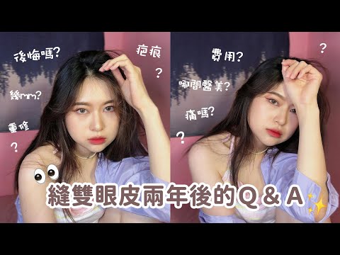 縫雙眼皮兩年後的Q&A👀我後悔嗎？診所費用公開！各種手術問題～【Angel蓁蓁 】