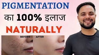 Pigmentation & Dark Spots का 100% इलाज (Treatment) Naturally