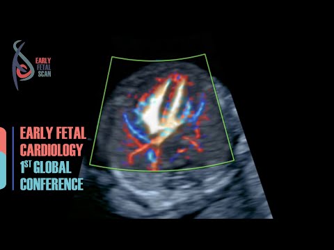 The 1st EARLY FETAL CARDIOLOGY Conference 2020