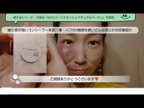 アザ隠し❗️どのアイテムがベストか❗️Hidden bruises ❗️ Which item is the best ❗️