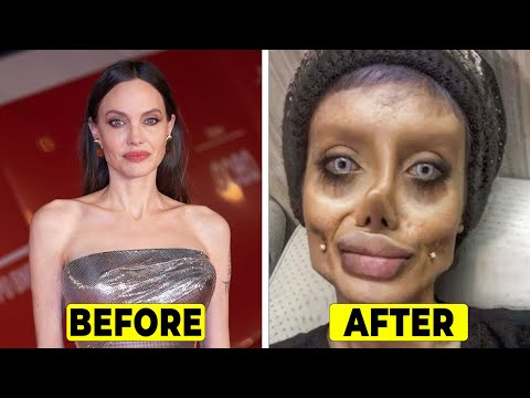 Famous Celebrities Who Destroyed Their Faces With Plastic Surgery!