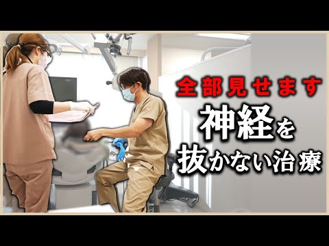 【 全部見せます 】神経取らない・抜かない治療　＃歯医者　＃直接覆髄法　＃MTA  ＃Vital Pulp Therapy