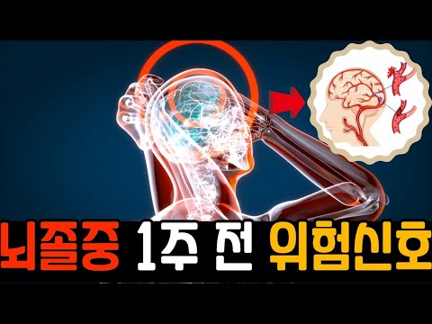 뇌졸중 오기 일주일 전 반드시 나타나는 증상들. 뇌졸중 전조증상