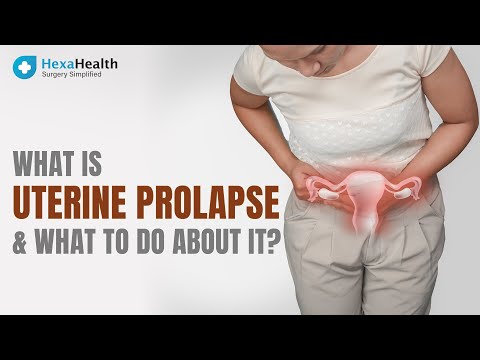 Uterine prolapse – why it happens & how to manage it? || HexaHealth expert Dr. Garima Goel