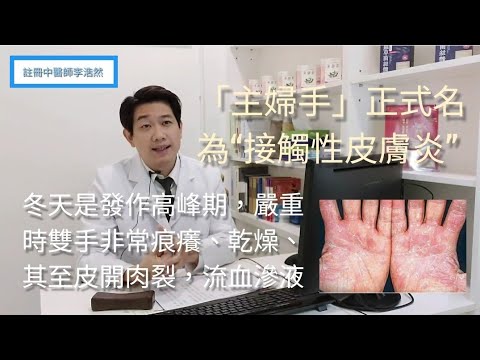 「主婦手」成因  預防  禁忌 中藥浸洗方。皮膚主治中醫師簡單講解