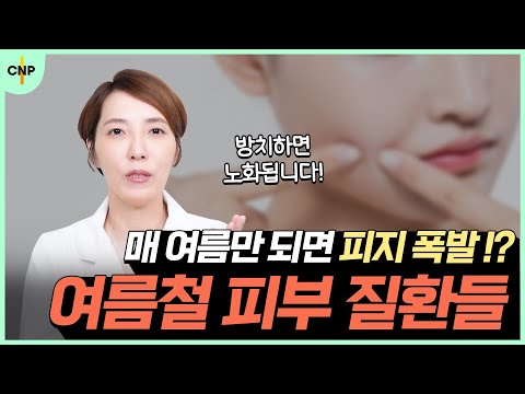 여름철 피부 질환을 미리 대비하라! 여름철 내 피부를 지키는 방법!