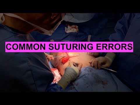 Common Suturing Errors & How to Avoid Them: Tips from a Plastic Surgeon