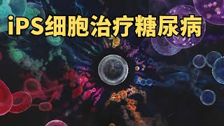 1型糖尿病不用再注射胰岛素？日本iPS细胞临床试验即将启动 (我们一起聊科学：20240907 第58期）