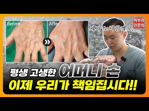 볼 수록 신경쓰이는 손주름!! 다시 젊어진 손 가질 수 있어요😆😆 #손주름 #레디어스 #어머니