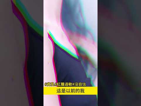 宅女僕變身性感精靈系正妹，隆乳手術的心得分享 台北教主 吳孟頴醫師