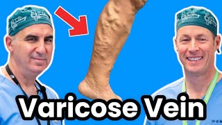 Varicose Vein Injections. Watch A Vascular Surgeon Do It!