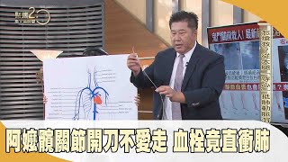 阿嬤髖關節開刀不愛走　血栓竟直衝肺【聚焦2.0】第496集