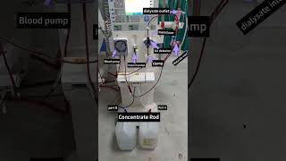 Parts of Dialysis machine      #nephrologist #dialysis #dialysisstudy #viralshorts #kidney