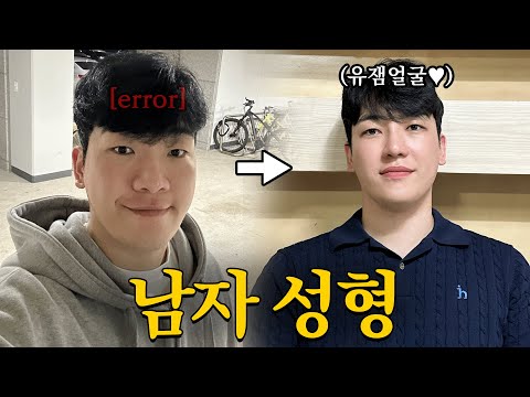 성형했더니 시선이 달라지더라고요ㅋㅋ.. | 남자 눈코수술✌ [시훈2Vlog]