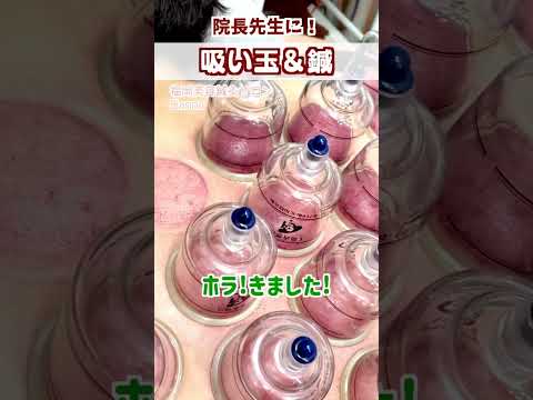 【吸い玉 院長】院長に恩返し吸い玉！