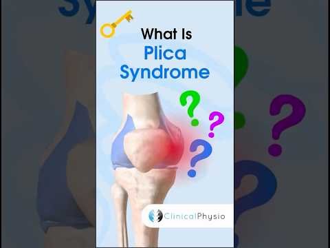 Plica Syndrome #physiotherapy #physicaltherapy #knee #kneepain