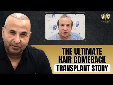 Life-Changing Hair Transplant Journey Ft. Mohd Beg | MedLinks