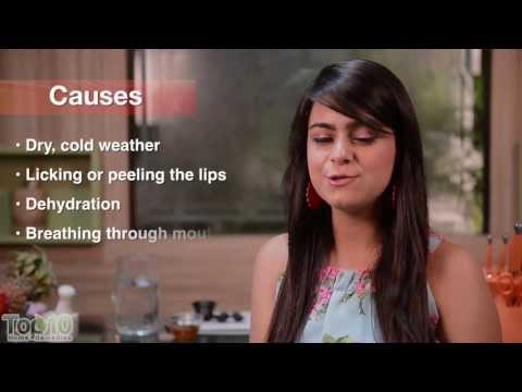 Home Remedies for Chapped Lips