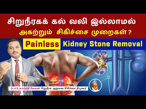 Kidney Stone Removal: The Pain-Free Solution - சிறுநீரக கல் வலி இல்லாமல் அகற்றும் சிகிச்சை முறைகள்?