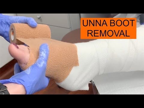 Wound Care UNNA BOOT Removal Tutorial