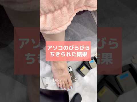 【婦人科形成】アソコのびらびらちぎられた結果#shorts